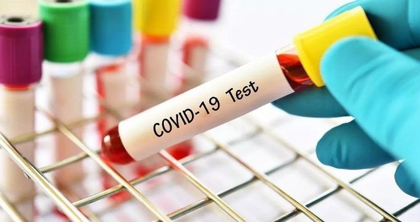 कोरोना की रफ्तार हुई स्लो: दिल्ली में 24 घंटे में आए 1072 नए केस, पॉजिटिविटी रेट 1.53% कोरोना की रफ्तार हुई स्लो: दिल्ली में 24 घंटे में आए 1072 नए केस, पॉजिटिविटी रेट 1.53%